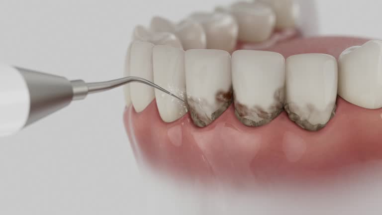 Trusted Dental Implants service in Mount Pleasant, PA - Dentist Open Now